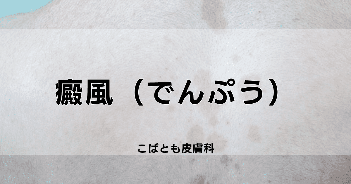 癜風　でんぷう