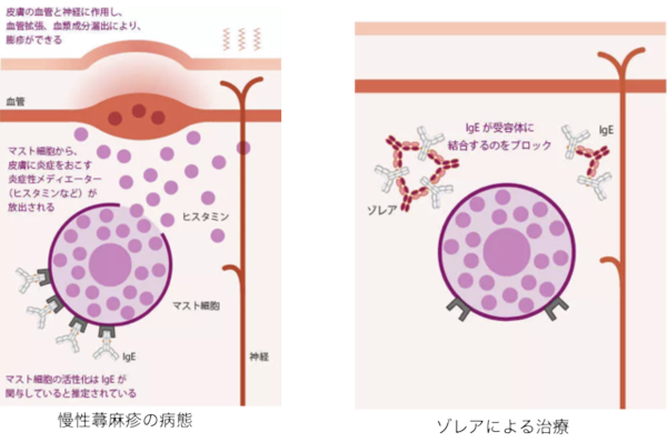 ゾレアの投与方法