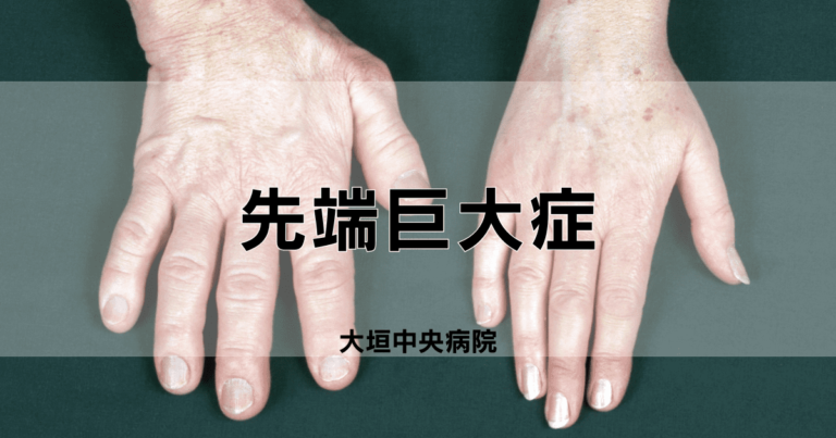 先端巨大症と巨人症とともに生きる