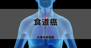 食道癌 esophageal-cancer-300x158.png