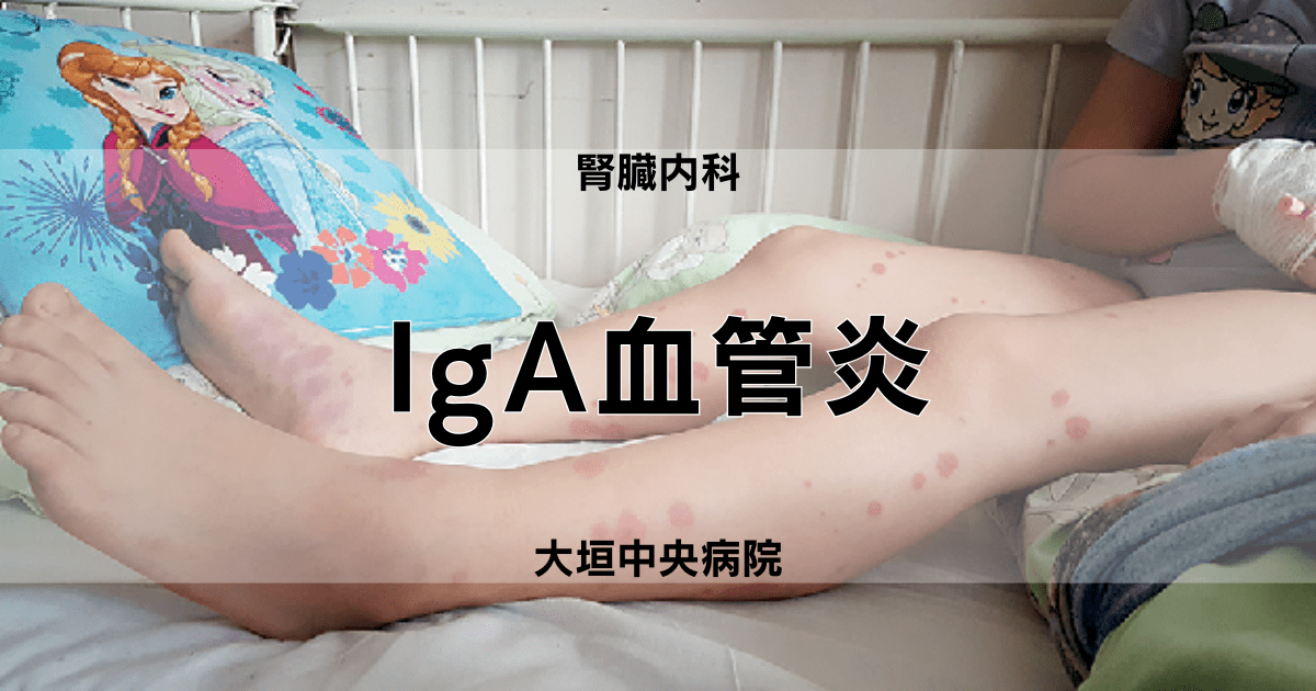 IgA血管炎