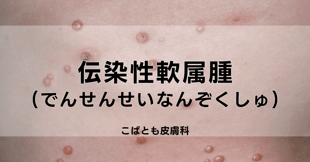 伝染性軟属腫　でんせんせいなんぞくしゅ