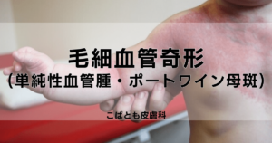 title-for-capillary-hemangioma