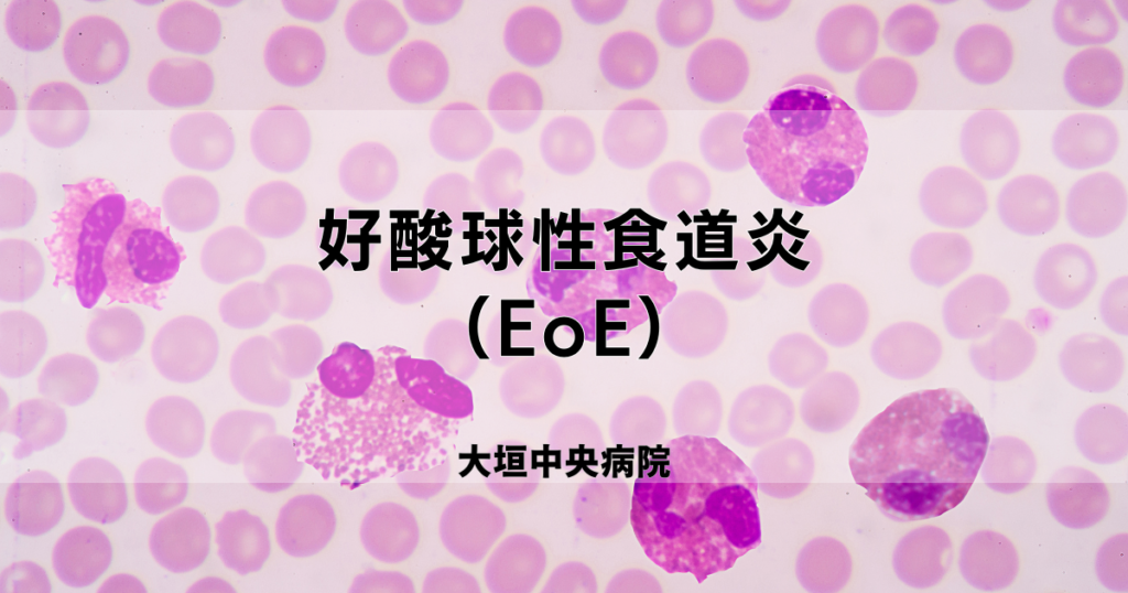 好酸球性食道炎の治療法は何ですか?