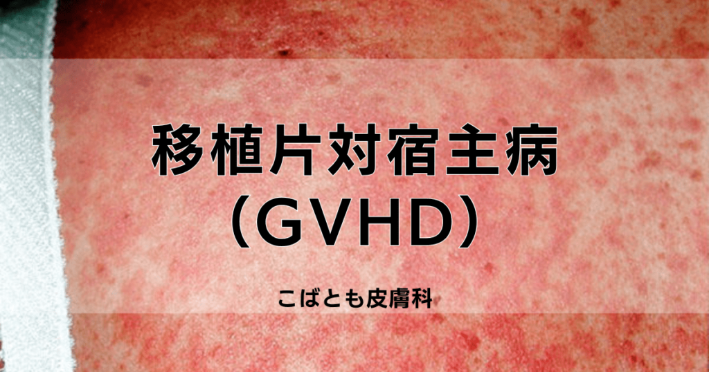 移植片対宿主病（GVHD）