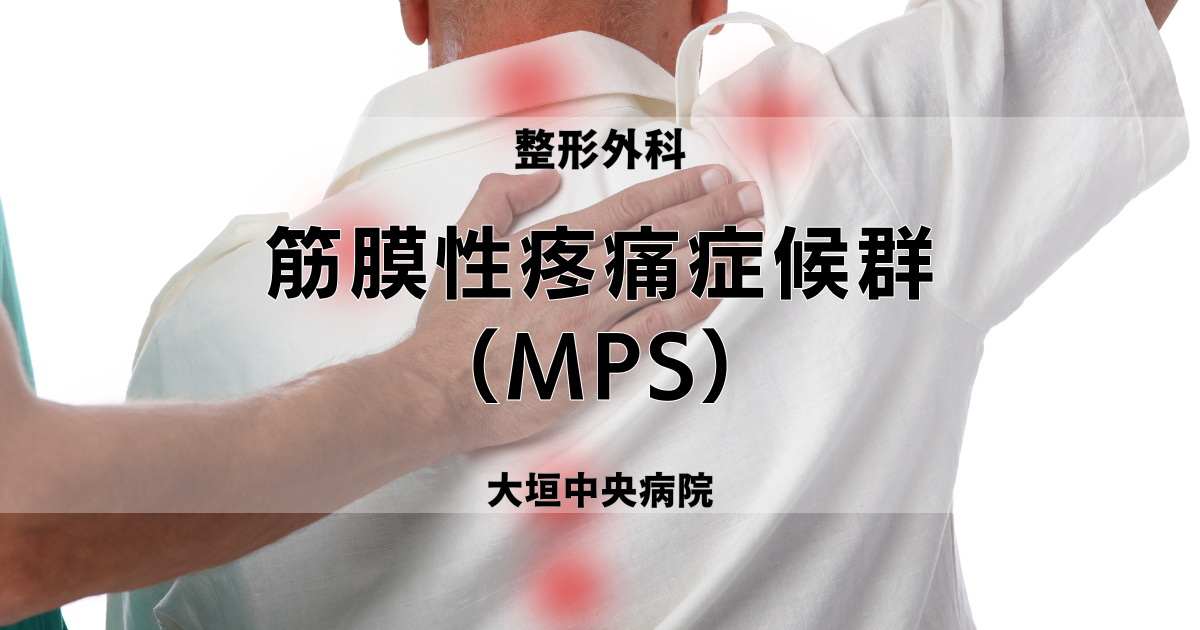 筋膜性疼痛症候群（MPS） | 医療法人社団豊正会 大垣中央病院