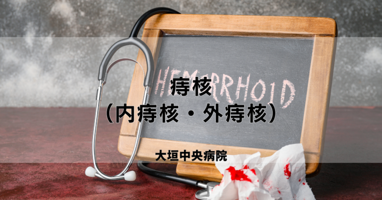 痔核(内痔核・外痔核) | 医療法人社団豊正会 大垣中央病院