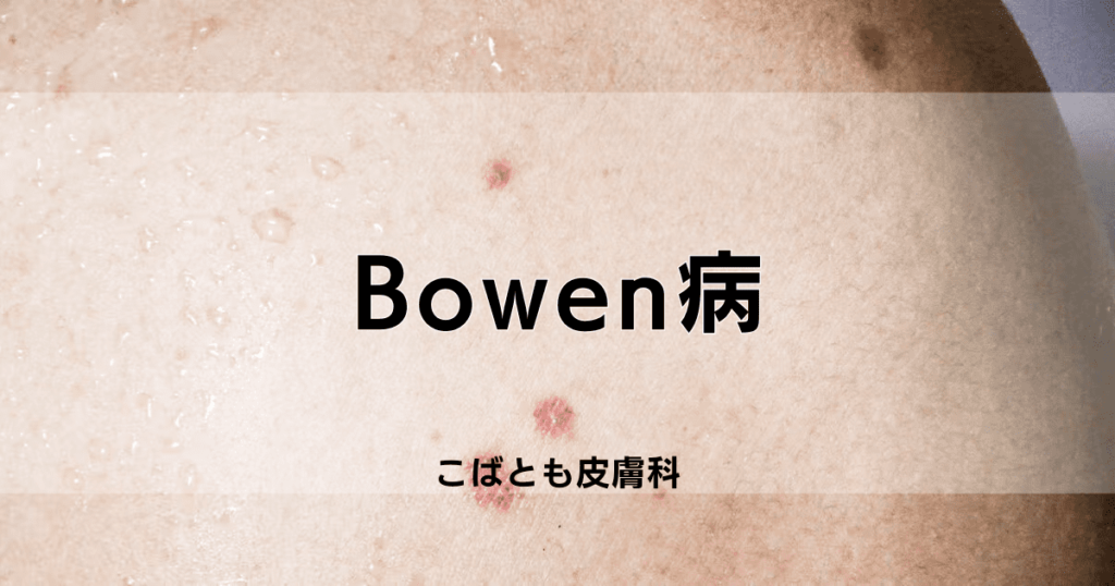 Bowen病