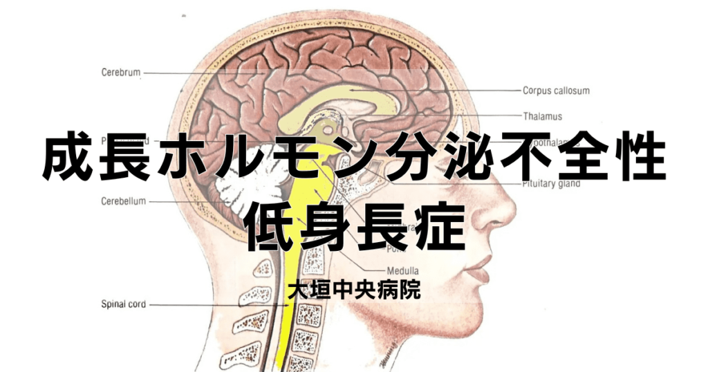 成長ホルモン分泌不全性低身長症