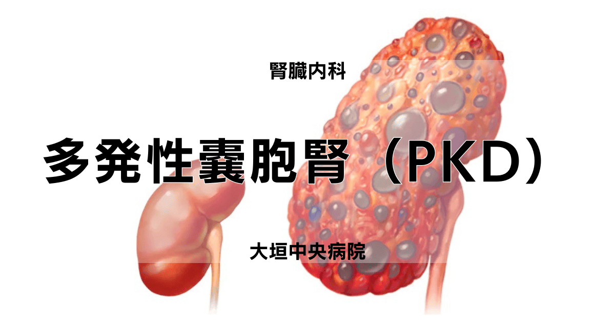 多発性嚢胞腎(PKD)