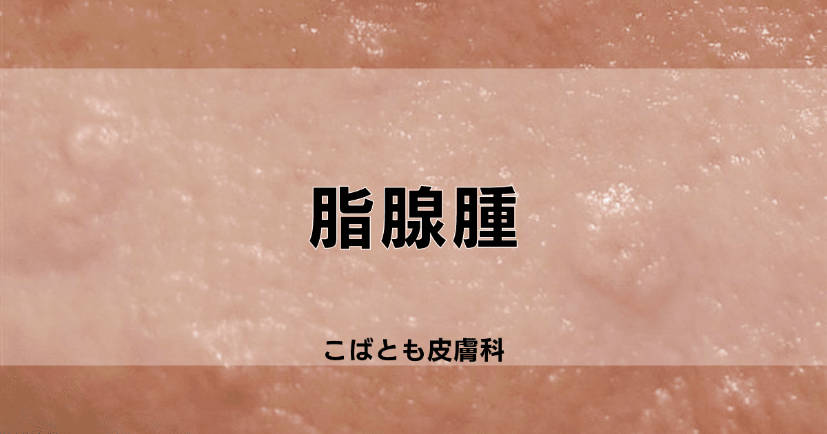 脂腺腫