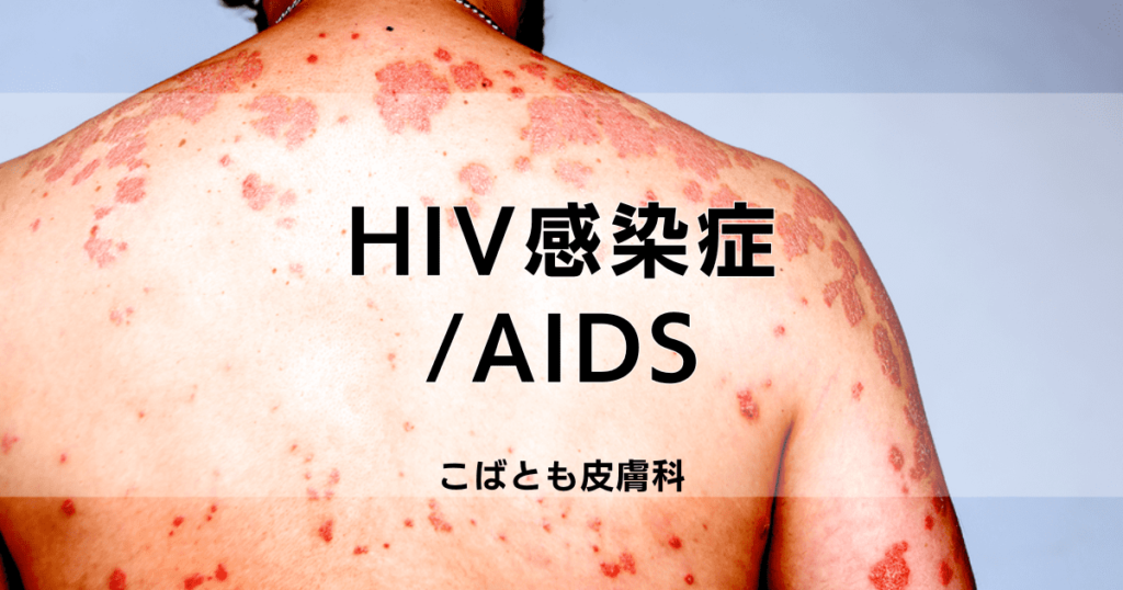 HIV感染症/AIDS