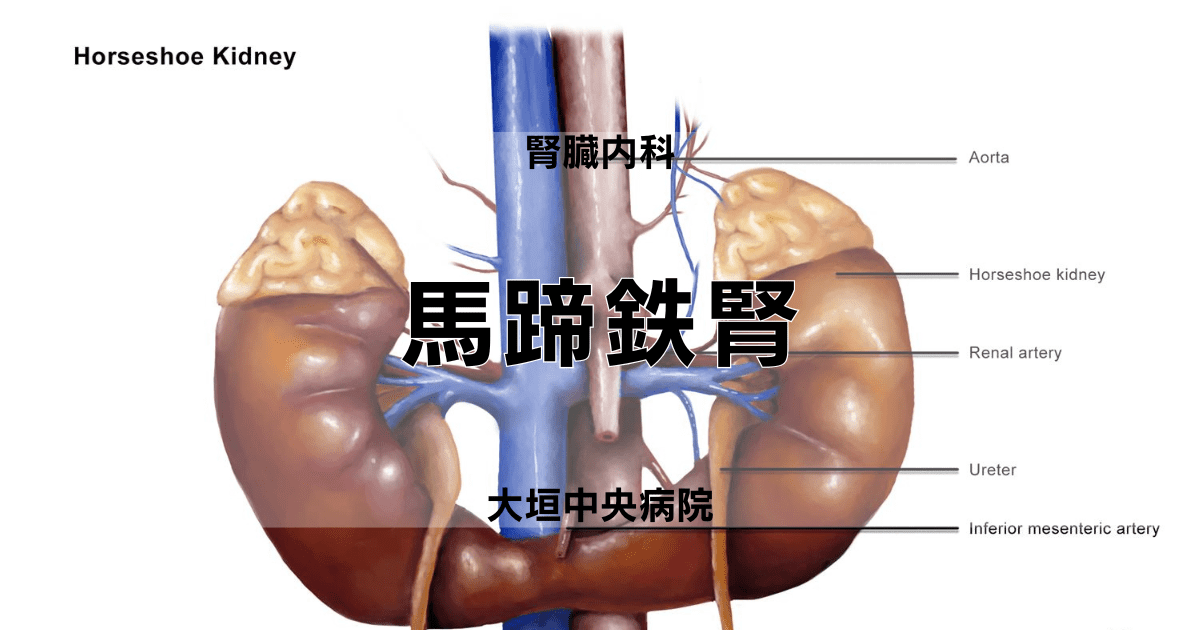 馬蹄鉄腎