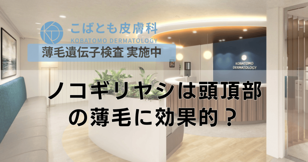 ノコギリヤシは頭頂部の薄毛に効果的？