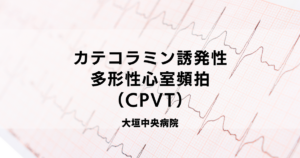 洞不全症候群（SSS） | 医療法人社団豊正会 大垣中央病院