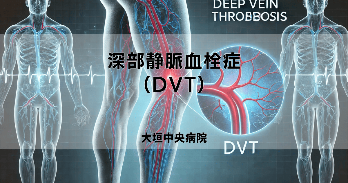 深部静脈血栓症（DVT）