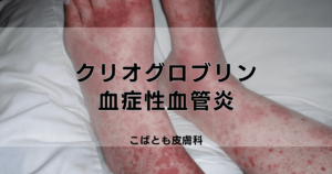 皮膚動脈炎｜こばとも皮膚科｜栄駅（名古屋市栄区）徒歩2分