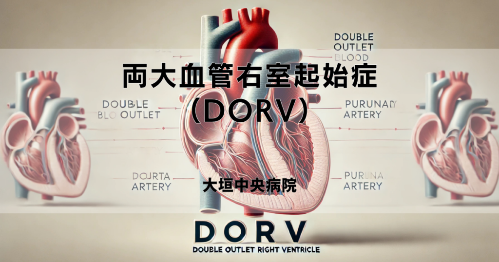 両大血管右室起始症（DORV）