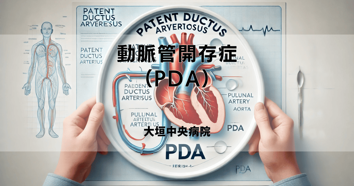 動脈管開存症（PDA）