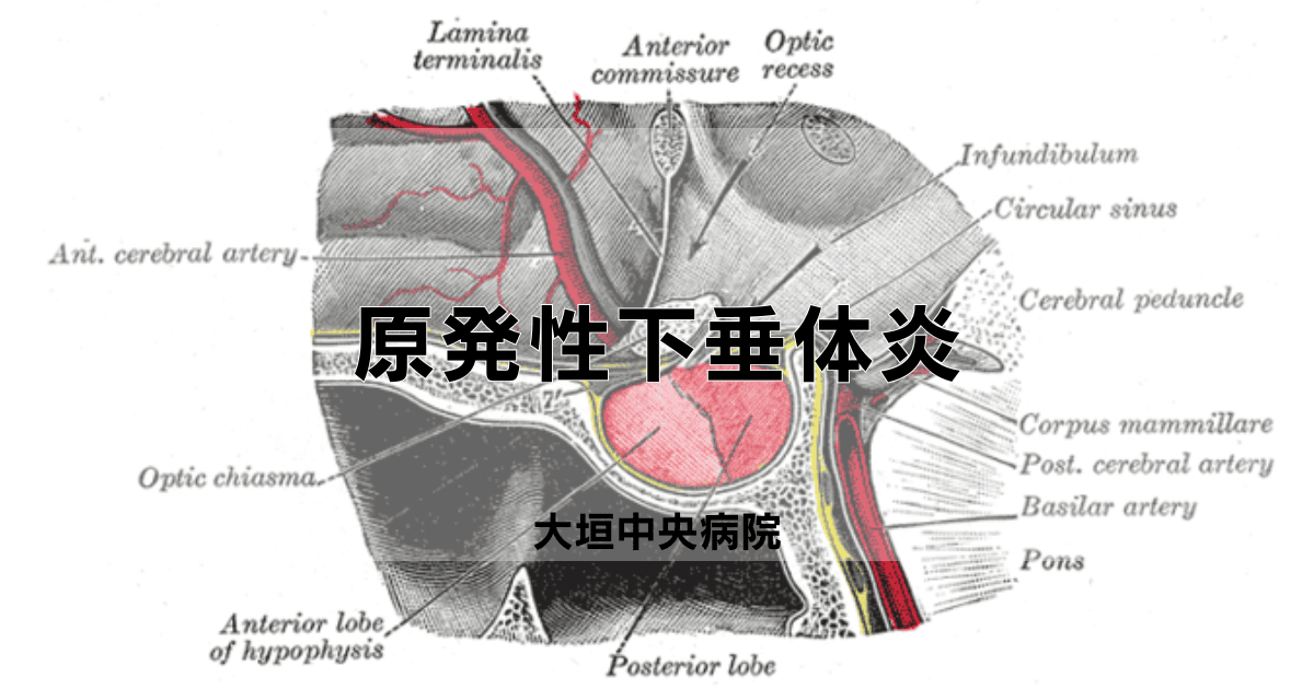 原発性下垂体炎