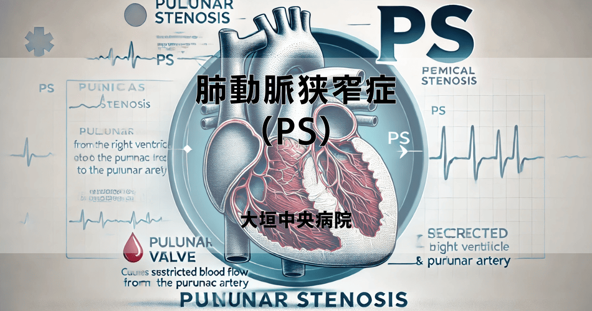 肺動脈狭窄症（PS）