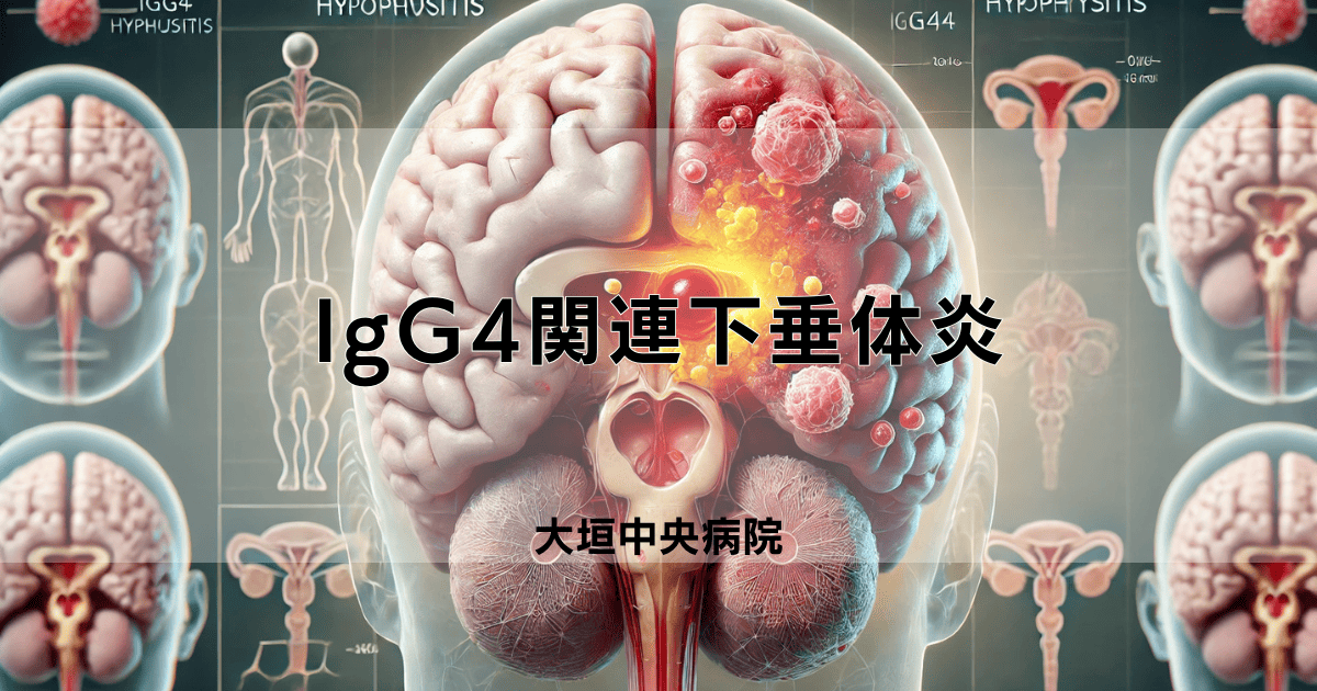 IgG4関連下垂体炎