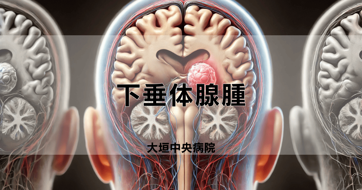 下垂体腺腫