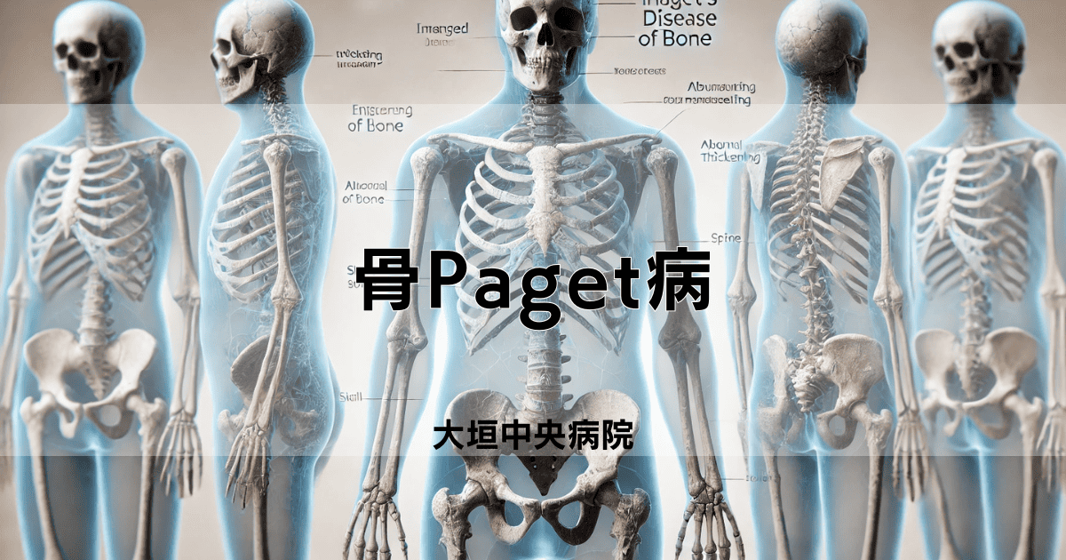 骨Paget病