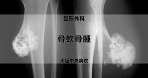 骨軟骨腫 | 医療法人社団豊正会 大垣中央病院