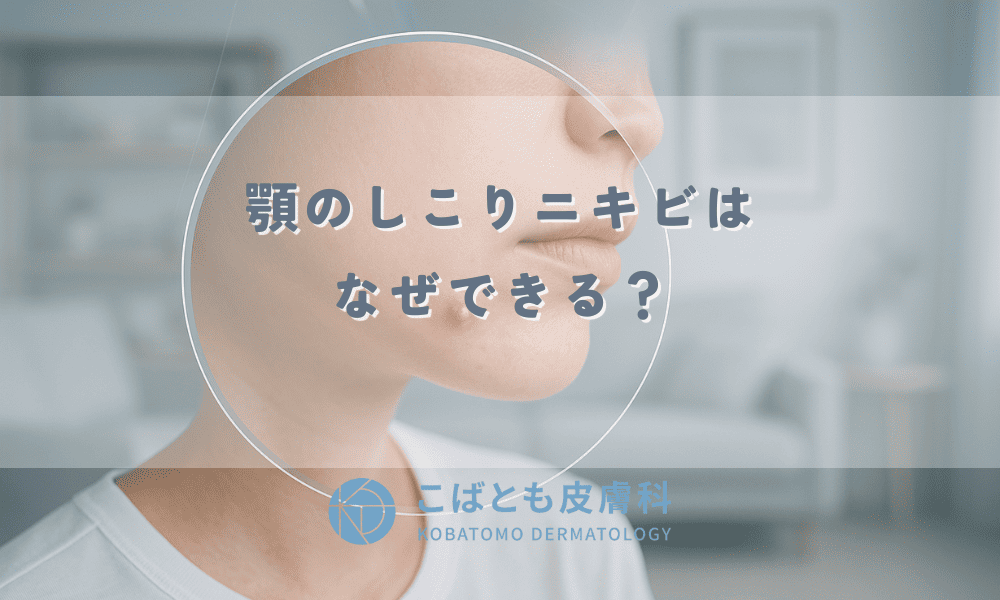 顎のしこりニキビはなぜできる？原因と効果的な治し方、悪化させないケア