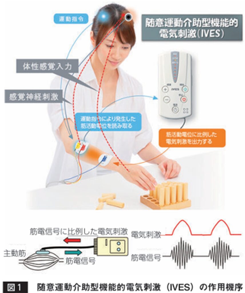 (原 行弘:機能的電気刺激を用いた脳 可塑性を生かすニューロリ ハビリテーション 参照)