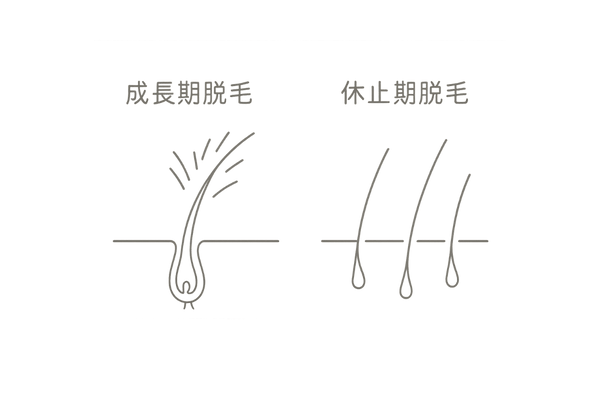 成長期脱毛と休止期脱毛のイメージ比較