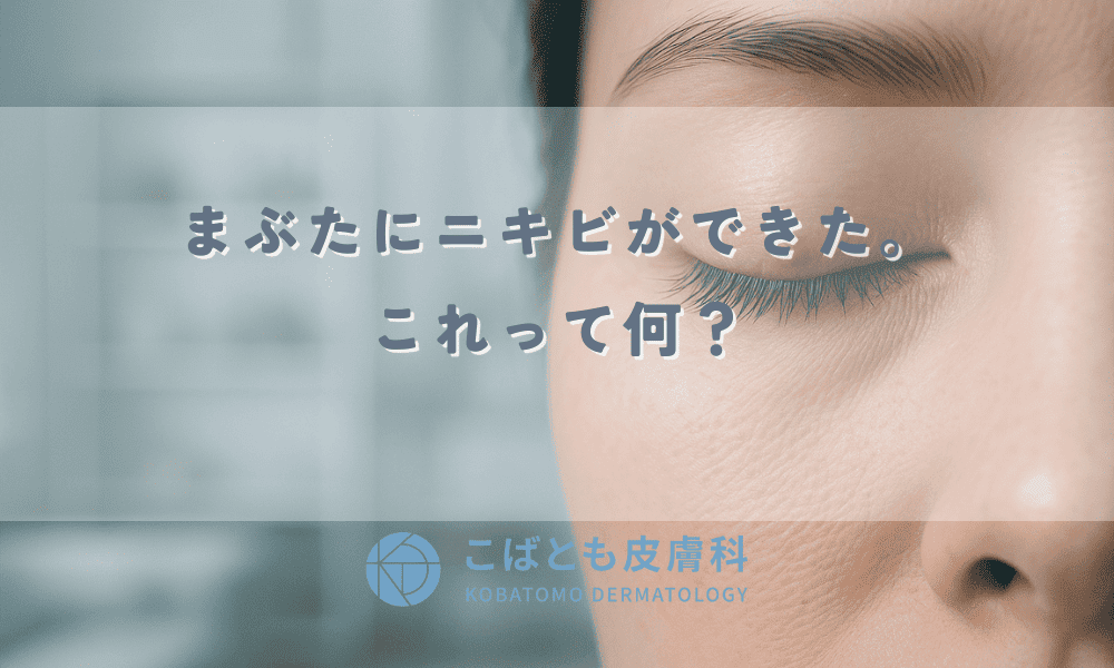 まぶたにニキビができた！これって何？原因と安全な対処法・治し方