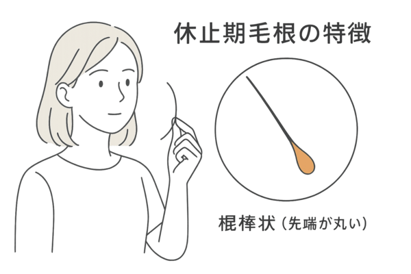 休止期脱毛の毛根の特徴