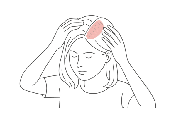 女性の髪を分け目から見ると地肌が透けて見える薄毛症状のイメージ