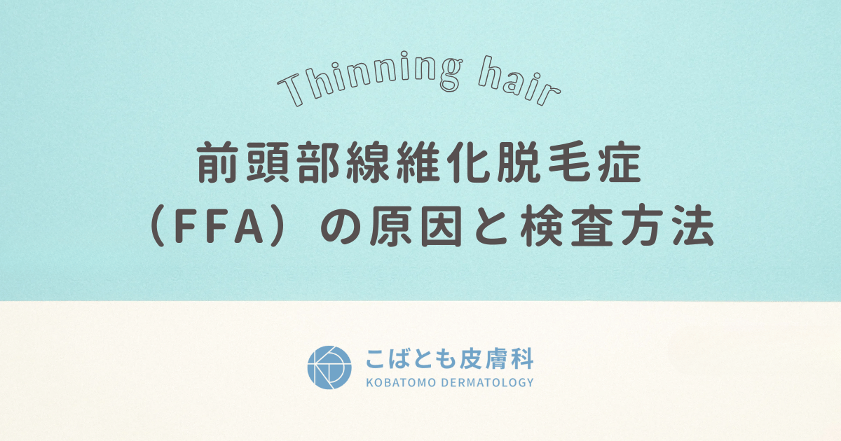 前頭部線維化脱毛症（FFA）の原因と検査方法