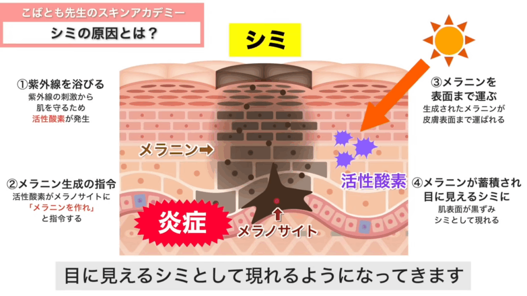 シミのメカニズム
