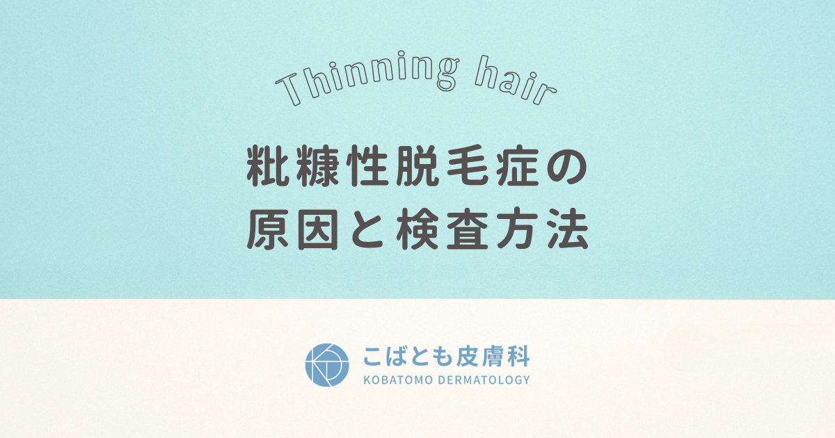 粃糠性脱毛症(ひこうせいだつもうしょう) の原因と検査方法