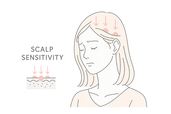 頭皮バリアが弱まり、刺激を受けやすくなっている様子