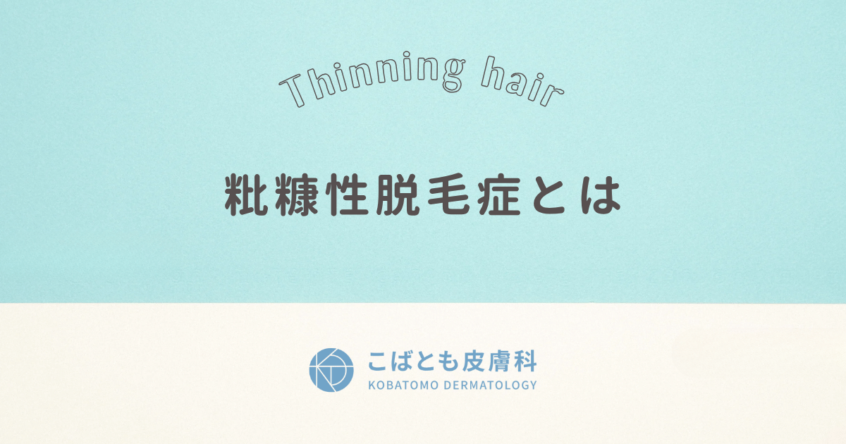 粃糠性脱毛症(ひこうせいだつもうしょう) とは