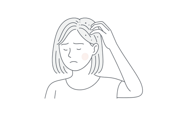 頭皮をかゆがる女性と細かいフケのイメージ