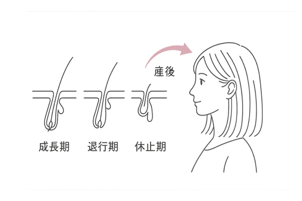 産後脱毛症の時期イメージ