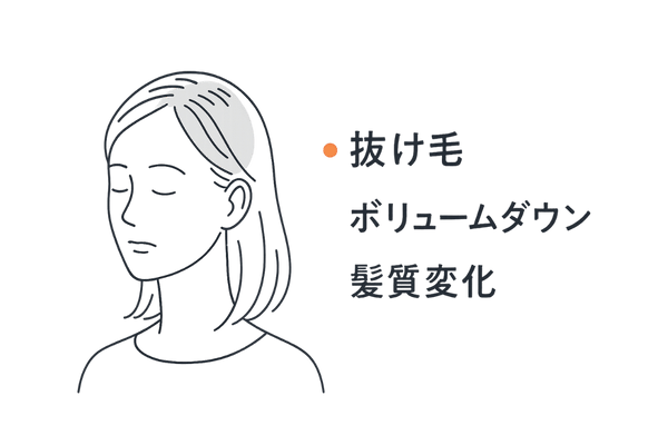 産後脱毛症の主な症状