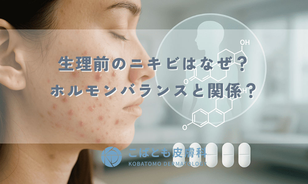 生理前のニキビはなぜ？ホルモンバランスと関係？原因と効果的な対策5選
