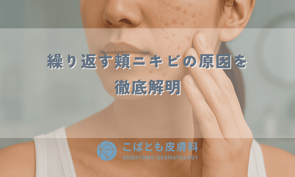 繰り返す頬ニキビの原因を徹底解明！生活習慣・スキンケアの見直し方
