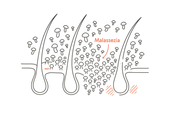 マラセチア菌(真菌)と頭皮のバリア機能が低下しているイメージ