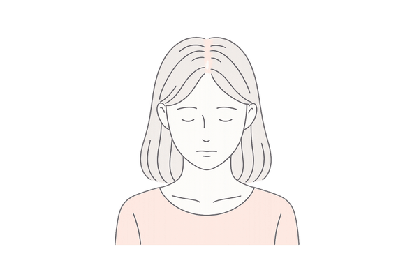 分け目が広がる抜け毛の様子