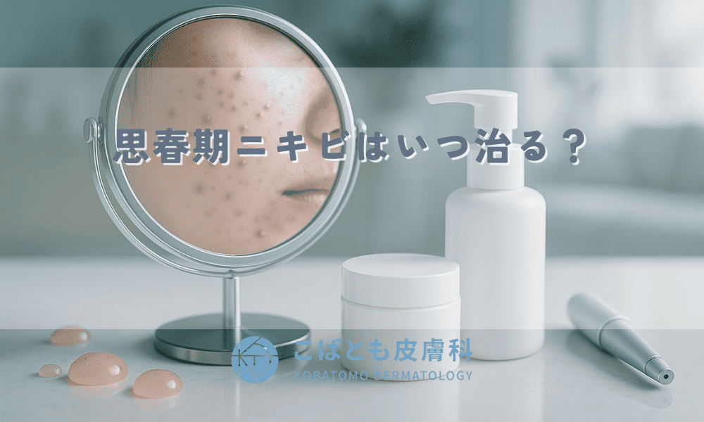 思春期ニキビはいつ治る？原因と正しいケア、皮膚科での治療法を解説