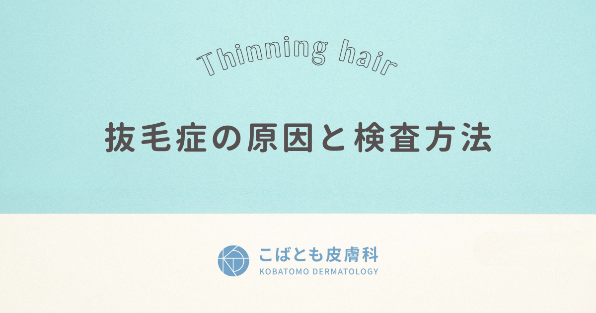 抜毛症（トリコチロマニア）の原因と検査方法