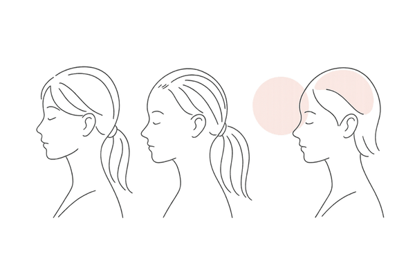薄毛の種類が多様であることをイメージさせる女性シルエットの線画イラスト